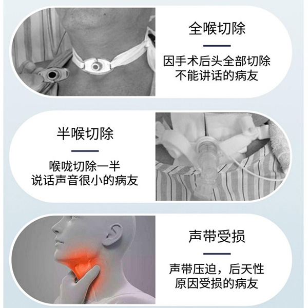 電子喉適用人群及操作方法