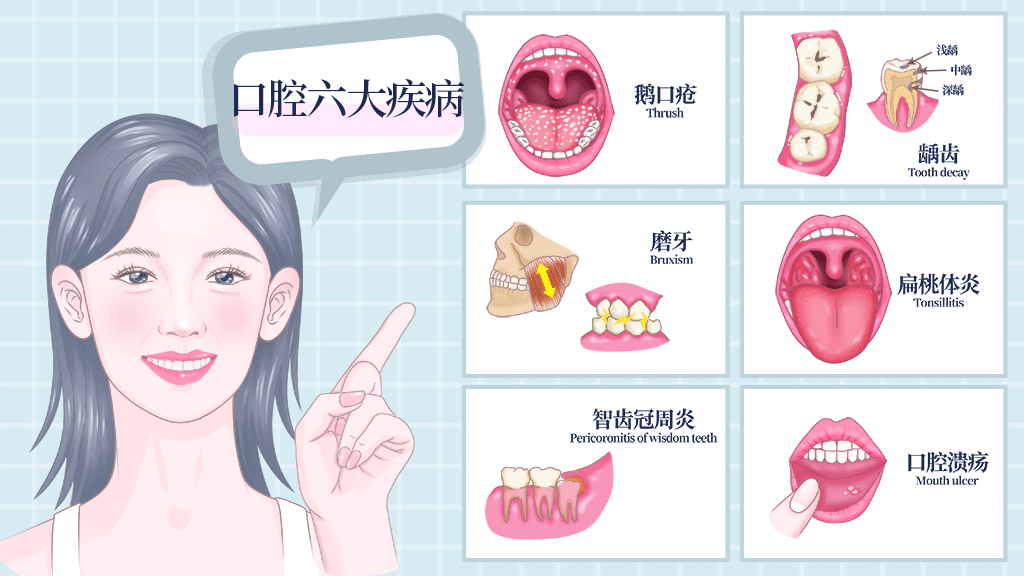 口腔疾病示例