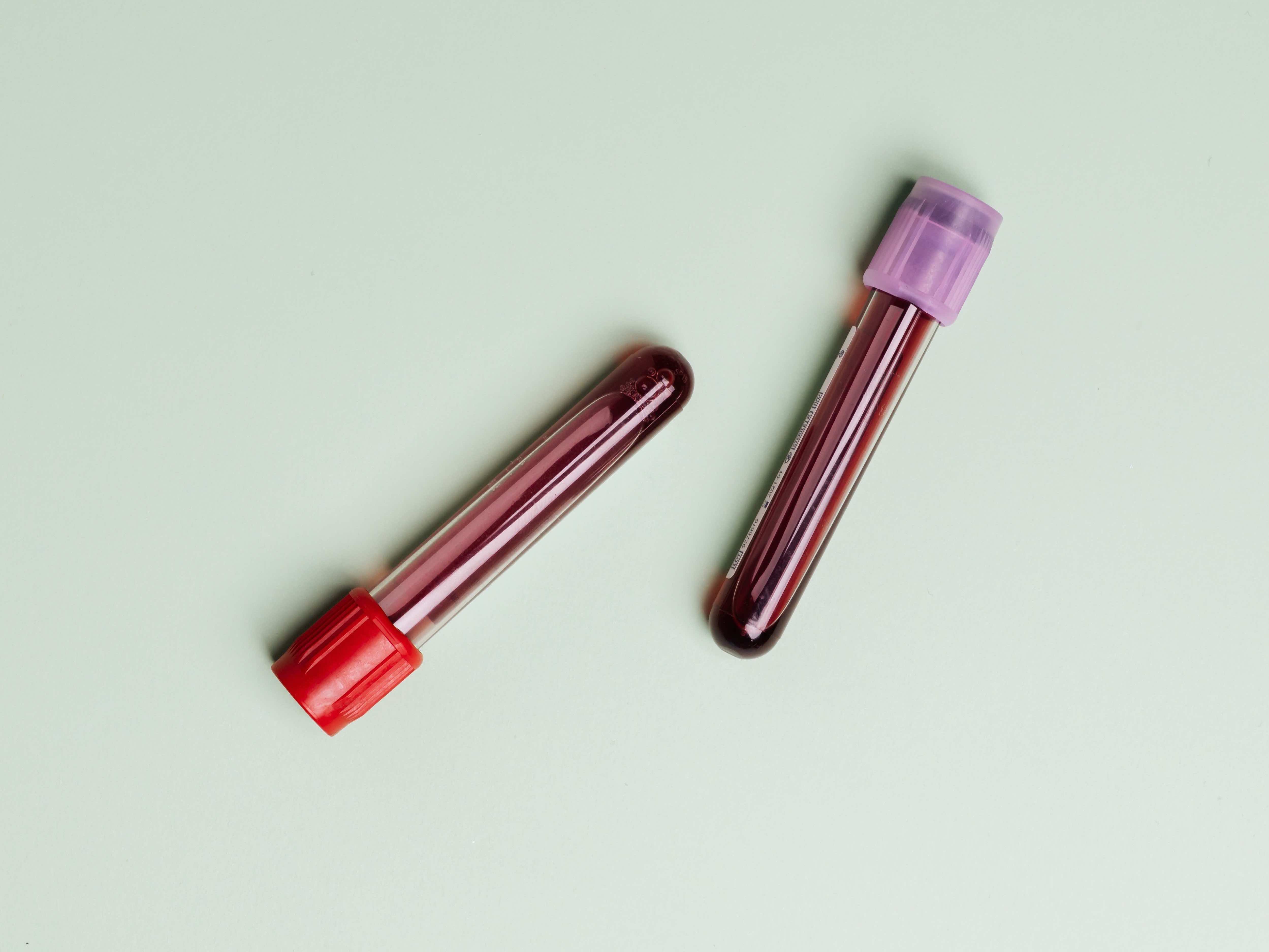 close-up-view-of-two-specimens-4047149(1)