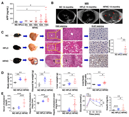 Dietary cholesterol drives fatty liver-associated liver cancer by modulating gut microbiota and metabolites