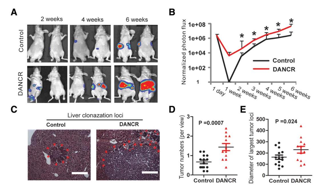 Long Noncoding RNA DANCR Increases Stemness Features of Hepatocellular Carcinoma by Derepression of ...