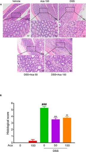 Acacetin Ameliorates Experimental Colitis in Mice via Inhibiting Macrophage Inflammatory Response an...