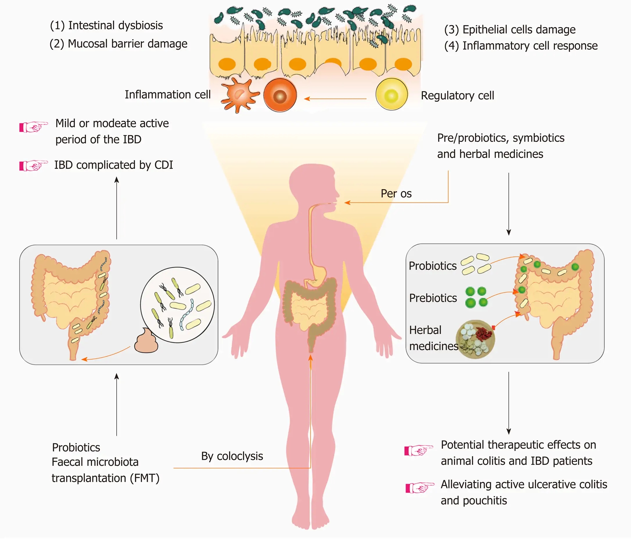 Regulation of the intestinal microbiota: An emerging therapeutic strategy for inflammatory bowel dis...