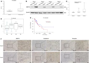 SCAP Mediated GDF15-Induced Invasion and EMT of Esophageal Cancer