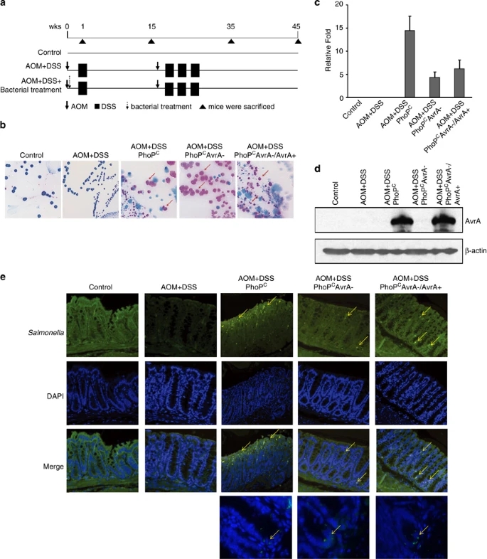 Enteric bacterial protein AvrA promotes colonic tumorigenesis and activates colonic beta-catenin signaling pathway