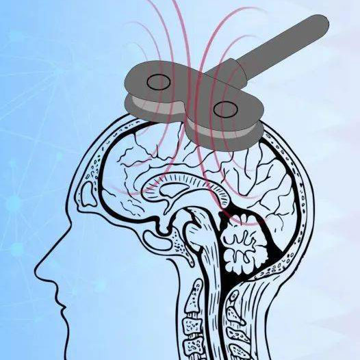 疼痛康復(fù)新技術(shù)——經(jīng)顱磁刺激技術(shù)