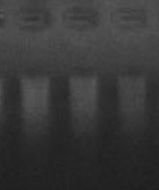 southern blot-2