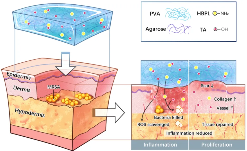 强韧、抗菌和抗氧化的水凝胶敷料加速伤口愈合抑制...