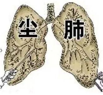 尘肺病的早期主要症状