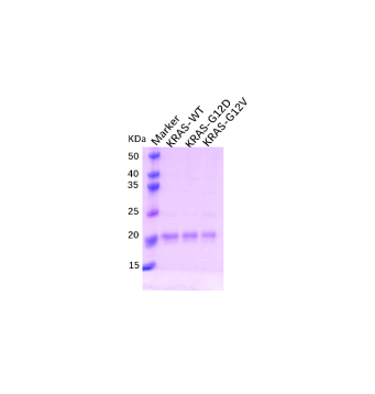 Human KRAS (G12D) Protein (His Tag)