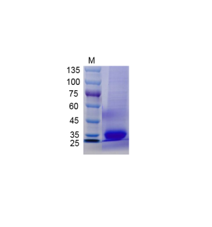 Human CD40 (His Tag)  Recombinant Protein