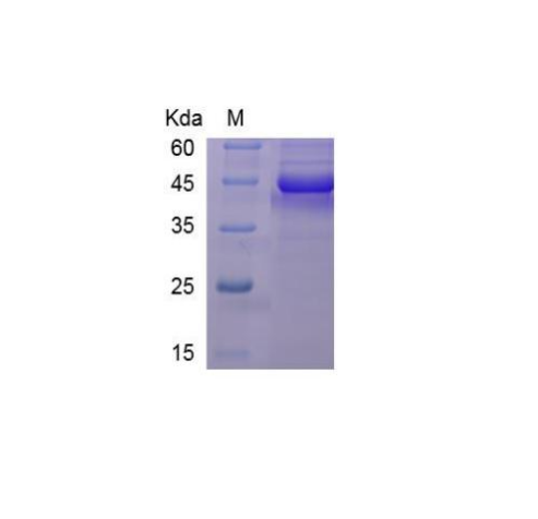 Human CD154 (Fc Tag) Recombinant Protein