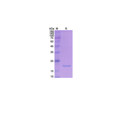 Human IL-4 (His Tag)   Recombinant Protein