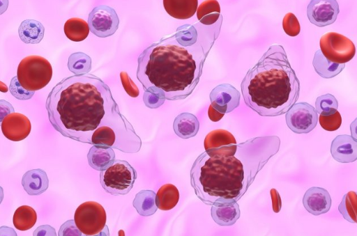 关于骨髓纤维化，你需要了解的7件事