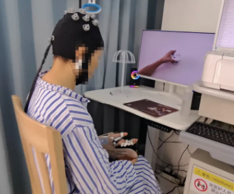 脑电波唤醒16岁少年瘫痪左手—睿瀚脑机接口+手功能康复