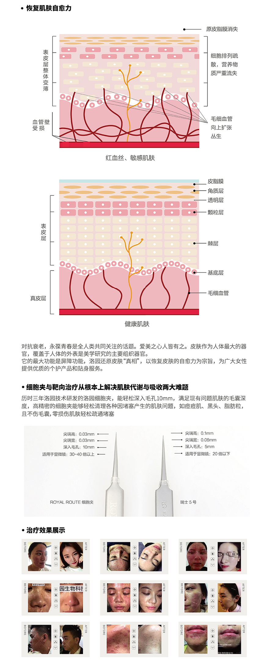 描述